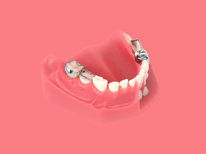 Retainers