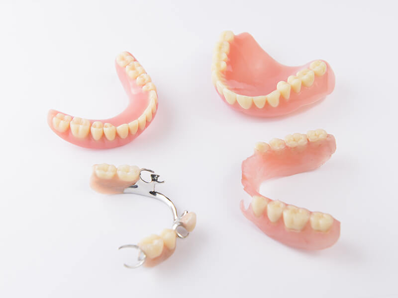 Retainers